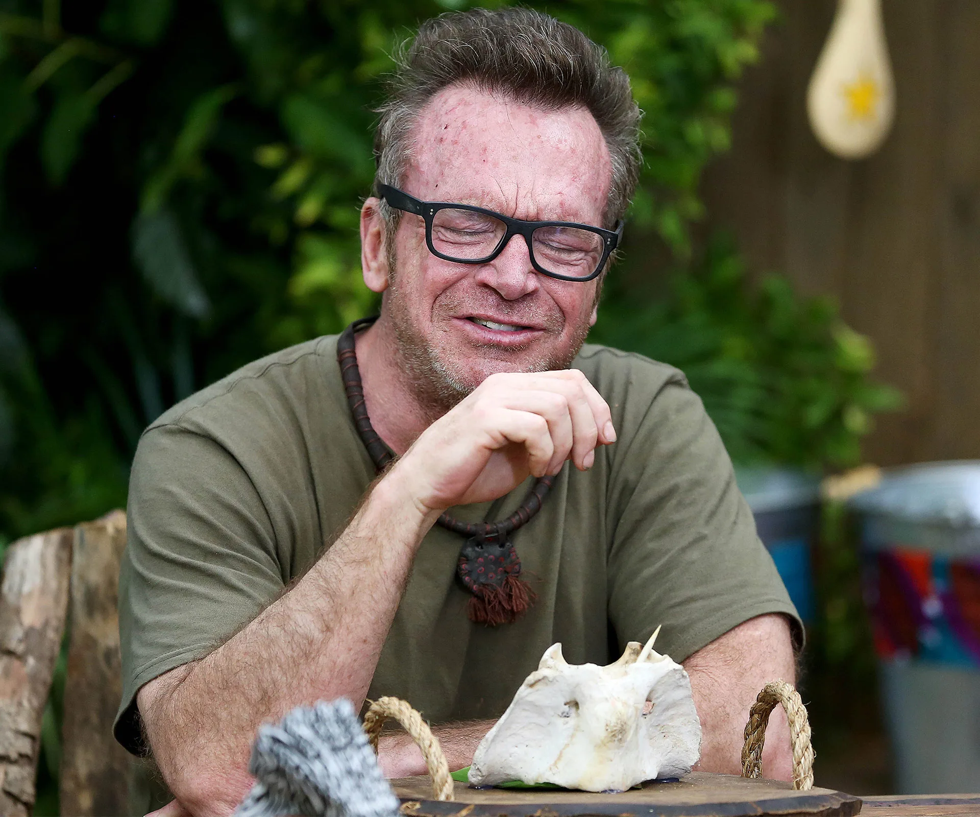 I'm A Celebrity star Tom Arnold