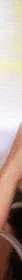 Asthma