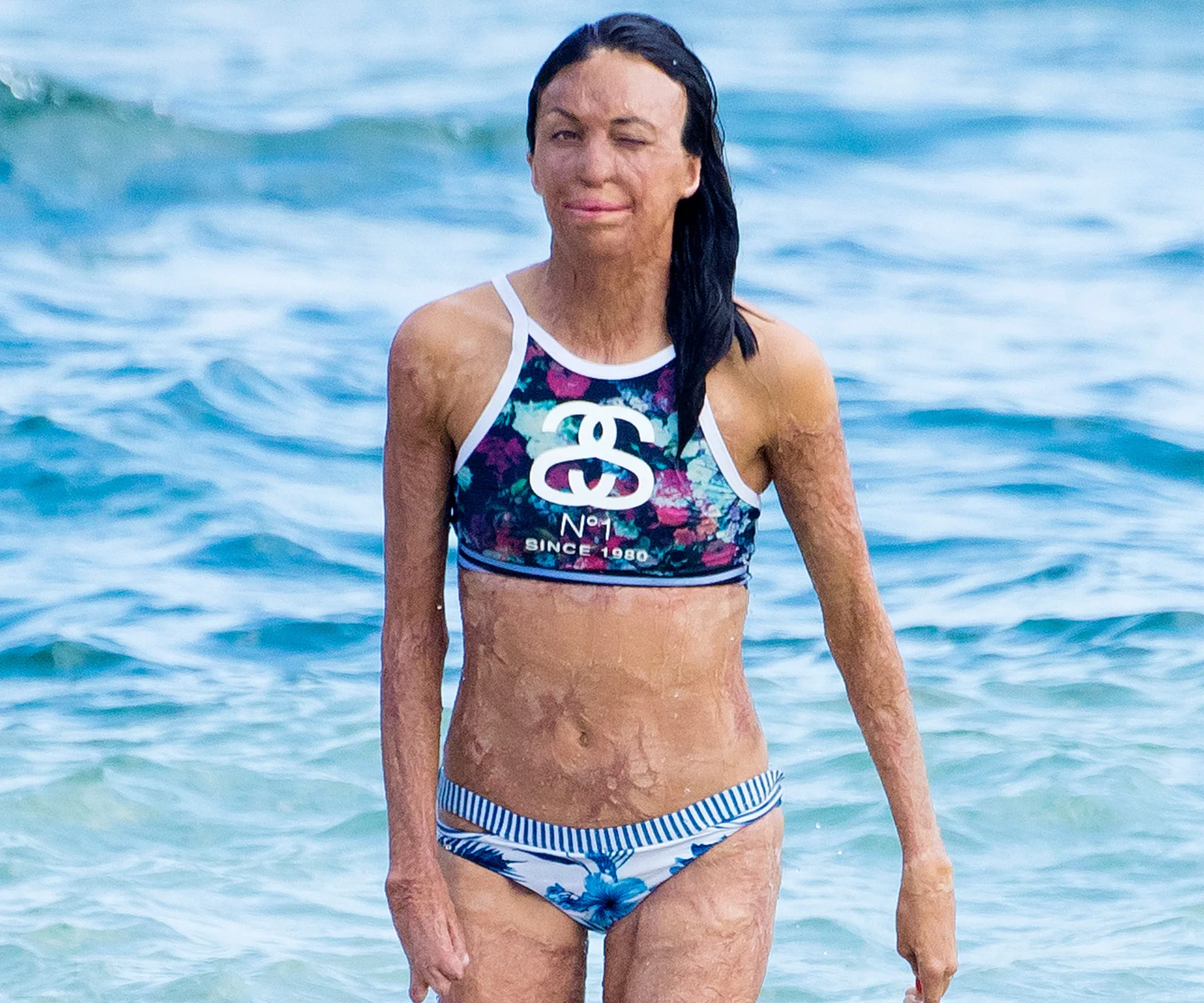 Turia Pitt