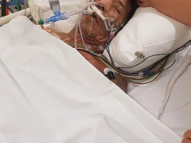 Man in hospital bed with ventilator and monitoring wires, recovering from severe spider bite complications.