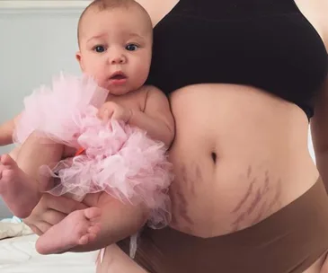 Woman in black sports bra holds baby wearing pink tutu, showing post-partum stretch marks on abdomen.