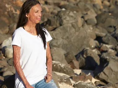 Portrait of a woman sitting on rocks, wearing a white t-shirt and jeans, looking off into the distance.