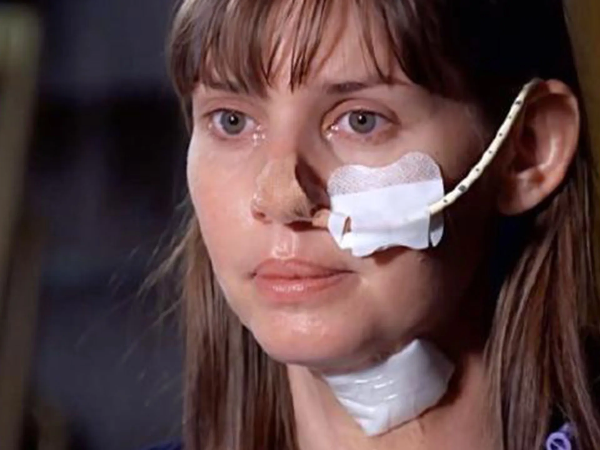 A woman with a tube on her face and a bandage on her neck, showing a hopeful expression.