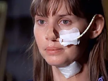 A woman with a tube on her face and a bandage on her neck, showing a hopeful expression.