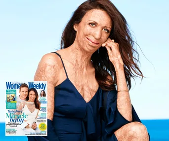 Turia Pitt posing in a blue dress with a Women’s Weekly magazine cover, featuring her and her partner, inserted in the image.