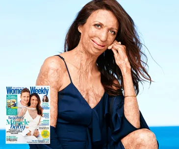 Turia Pitt posing in a blue dress with a Women’s Weekly magazine cover, featuring her and her partner, inserted in the image.