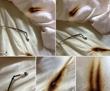 Close-up of a damaged charger cable and burnt fabric, indicating potential fire risk.