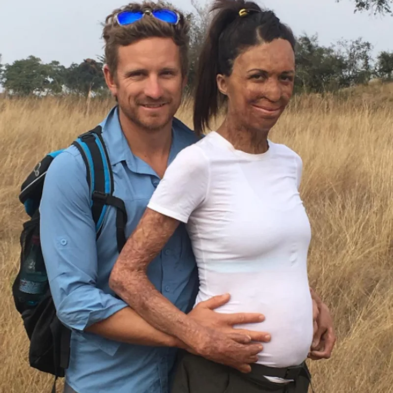 Turia Pitt and Michael Hoskin