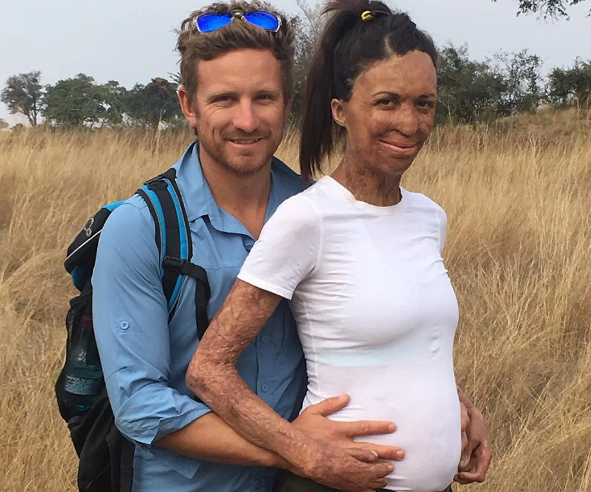 turia Pitt