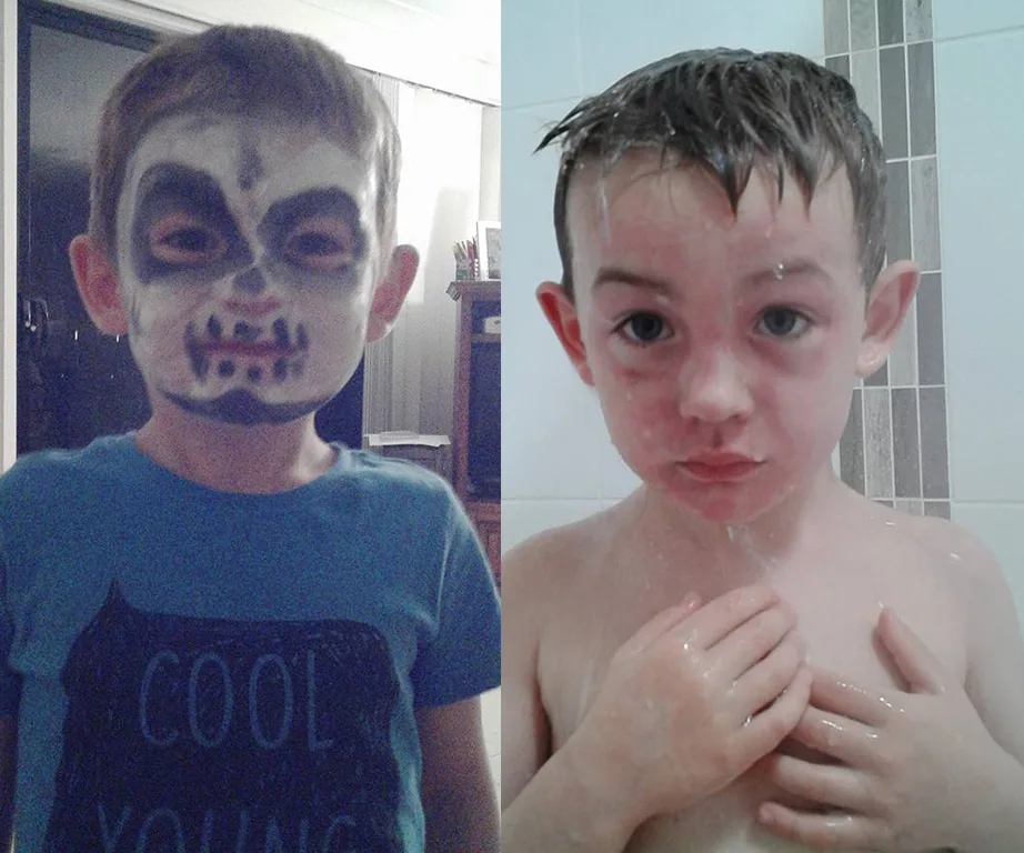 A child with Halloween face paint on the left and the same child with a red, irritated face after washing on the right.
