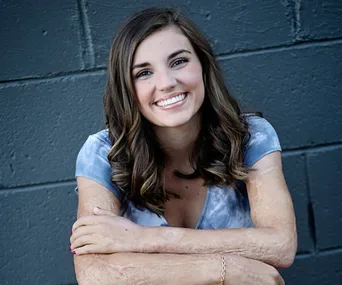 Young woman with long hair smiling against a dark brick wall, showing visible burn scars on her arms.