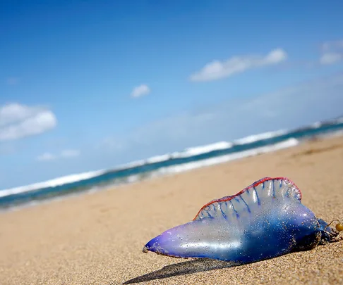 how to treat a blue bottle sting