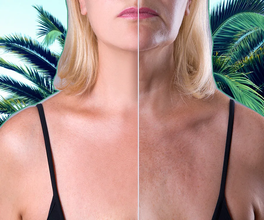 Split image of a woman's face and shoulders, contrasting youthful and aged skin under palm leaves.