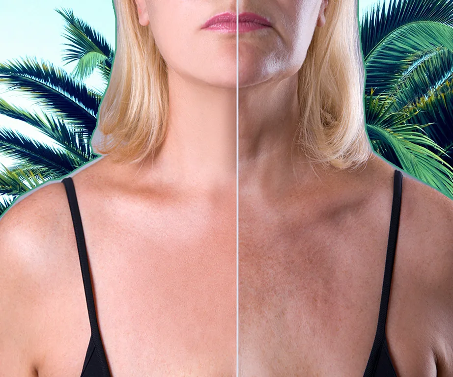 Split image of a woman's face and shoulders, contrasting youthful and aged skin under palm leaves.