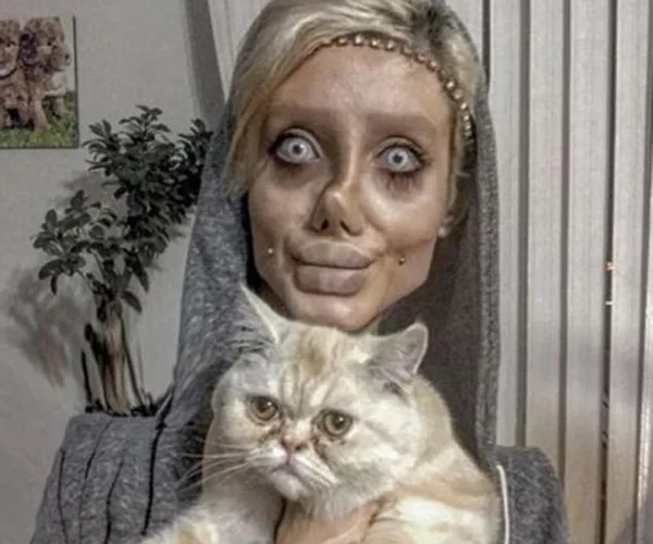 Iranian teenager surgery Angelina Jolie