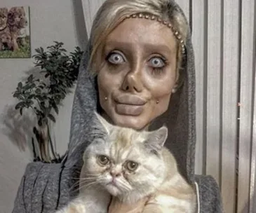 Iranian teenager surgery Angelina Jolie