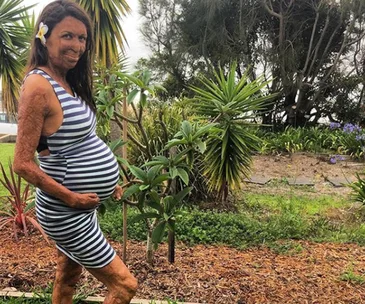 Turia Pitt and Michael Hoskin