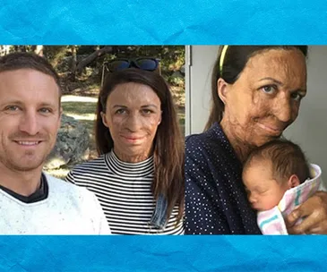 Turia Pitt and Michael Hoskin
