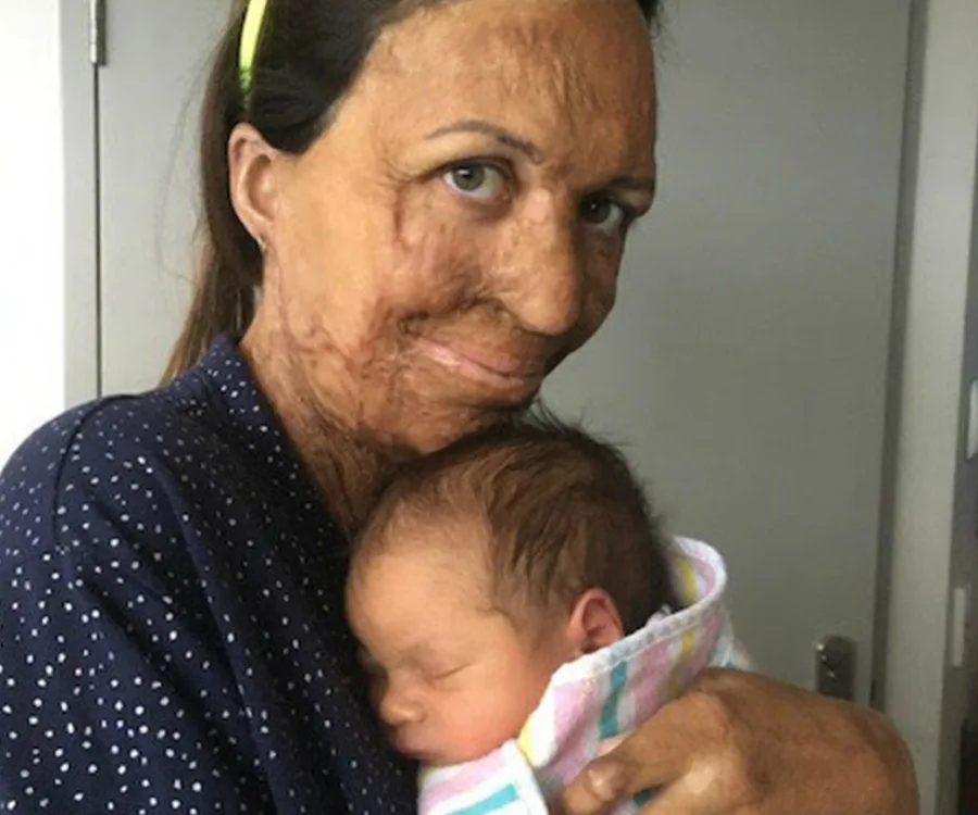 A woman gently embraces a newborn wrapped in a striped blanket, both are indoors.