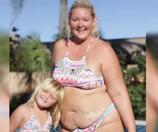 Instagram mum's twist on "before and after"