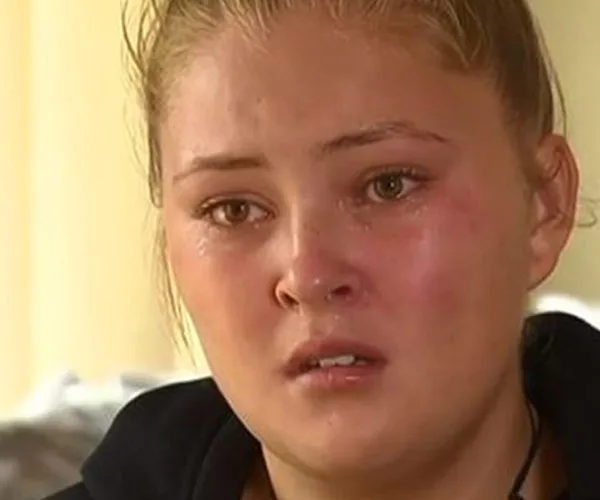 13-year-old speaks out after suffering bullying for years