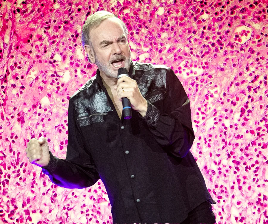 How Parkinson’s disease works – and how it will change Neil Diamond’s life forever