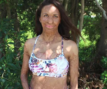 Turia Pitt’s VERY DETAILED account of her birth