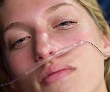 Woman lying down with a nasal oxygen tube, eyes gently open, looking serene post-transplant.