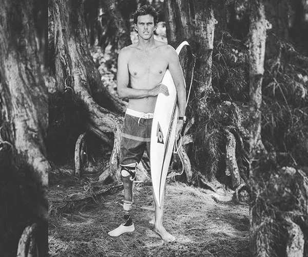 Surfing amputee stands shirtless with surfboard in forest, showcasing prosthetic leg and surfing shorts.