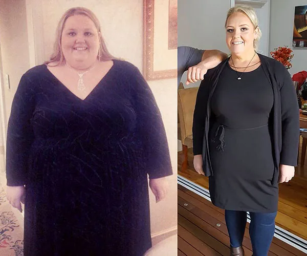 Before and after weight-loss photos of a woman wearing a black dress, showing significant transformation.