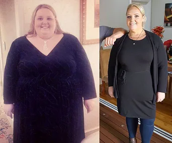 Before and after weight-loss photos of a woman wearing a black dress, showing significant transformation.
