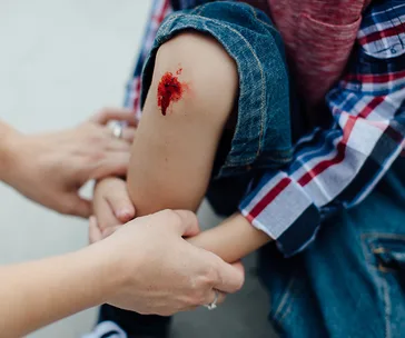 Child with scraped knee wearing denim shorts and plaid shirt; someone tends to the wound.