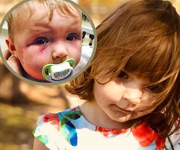 Young girl with windblown hair outdoors, inset of baby with bruised face and pacifier.