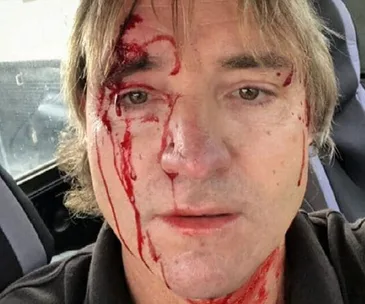 Perth father attacked for driving too slow