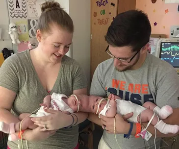 Parents holding conjoined twin babies connected at the abdomen, with medical tubes attached in a hospital room.
