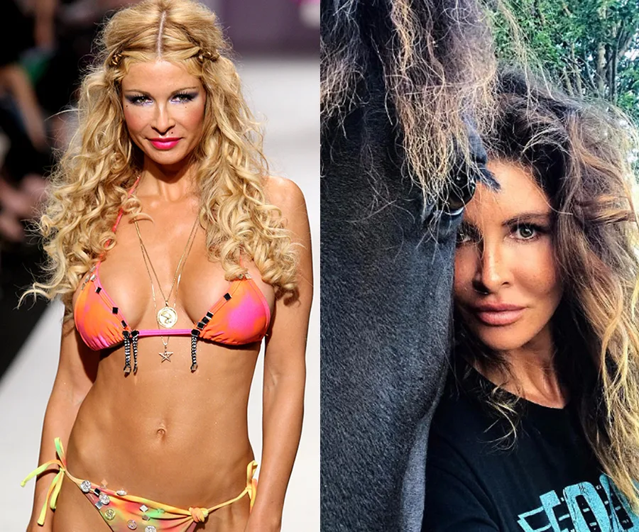 Nicola Robinson breast implants