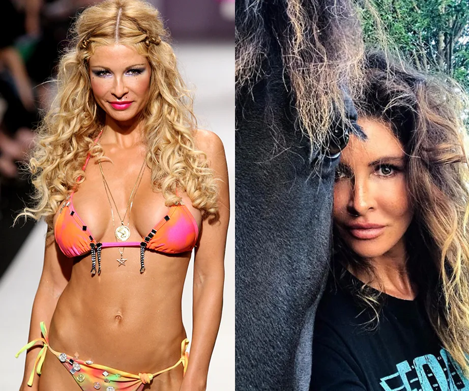 Nicola Robinson breast implants