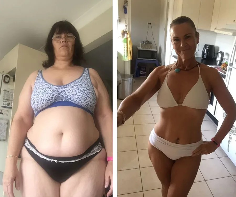 Before and after weight loss: woman in underwear, left shows before, right shows after, highlighting transformation.