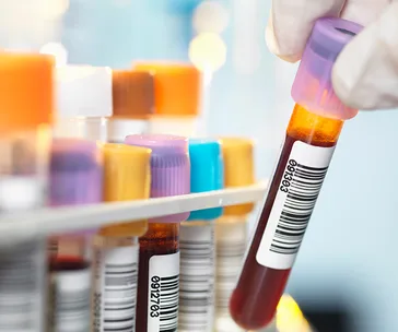 Blood sample vials with barcodes, gloved hand holding one, related to cancer testing.