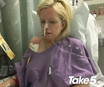 Woman in a hospital bed with medical tubes, wearing a purple gown, appearing tired or unwell.