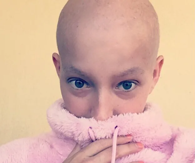 A person with no hair covers their mouth with a pink fuzzy sweater, showing only their eyes and forehead.