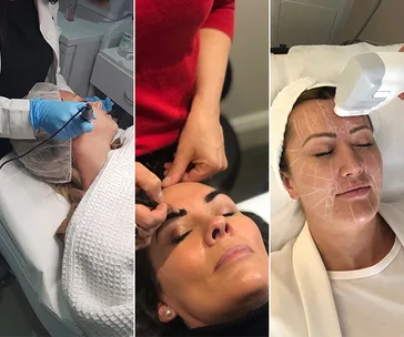 Three-panel image of different facial treatments: microdermabrasion, eyebrow shaping, and laser therapy.