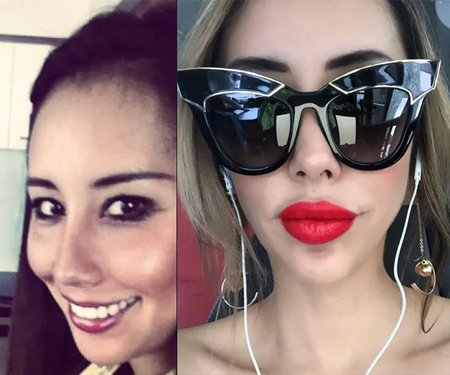 Two side-by-side images show a woman before and after a cosmetic transformation, with noticeable changes in appearance.