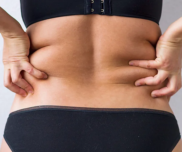 Person pinching skin on lower back, revealing folds, wearing black undergarments.