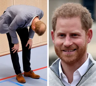 Two images of a red-haired man: left, bent over; right, smiling in a casual outfit.