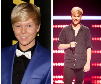 The Voice star Jack Vidgen admits he’s had fillers – but denies having surgery