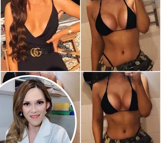 Collage showing before and after photos of a woman's breast augmentation, with a female doctor in a circular inset.