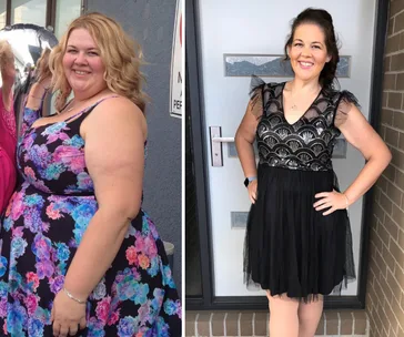 Before and after photo showing significant weight loss transformation in a woman, wearing floral and patterned dresses.
