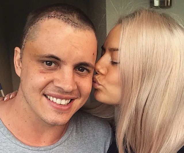 A smiling man with staples on his head is kissed on the cheek by a woman with blonde hair.
