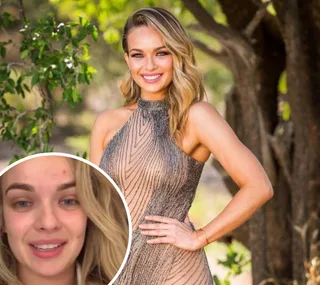 A woman in a shimmering dress smiles outdoors, with a close-up inset of her face without makeup.